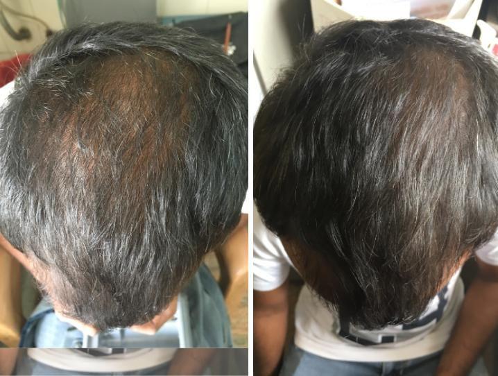 before-after