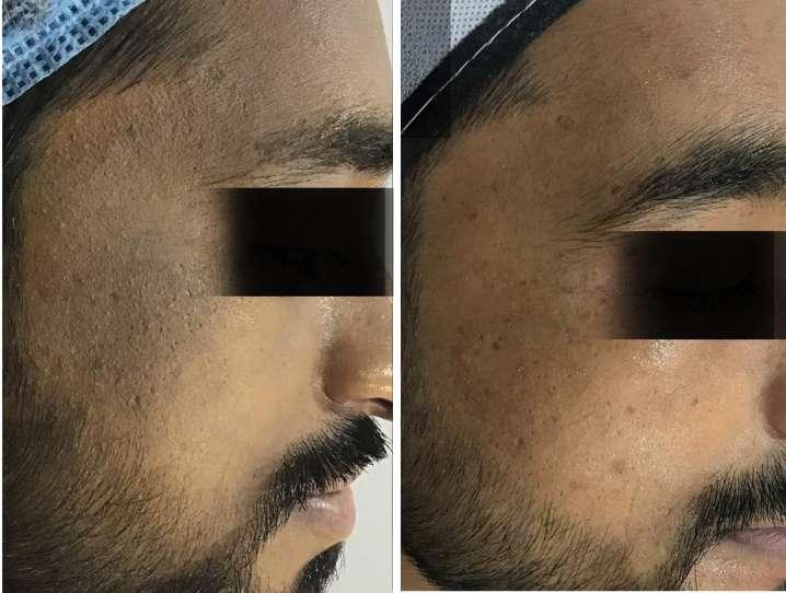 before-after