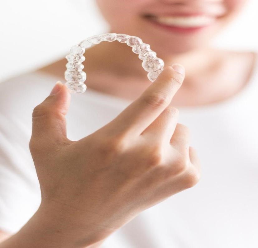 Everything You Need To Know About The Best Alternative To Teeth Clips, i.e. Aligners