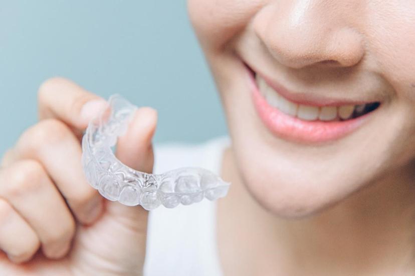 Know Which Type of Braces is Trending Today!