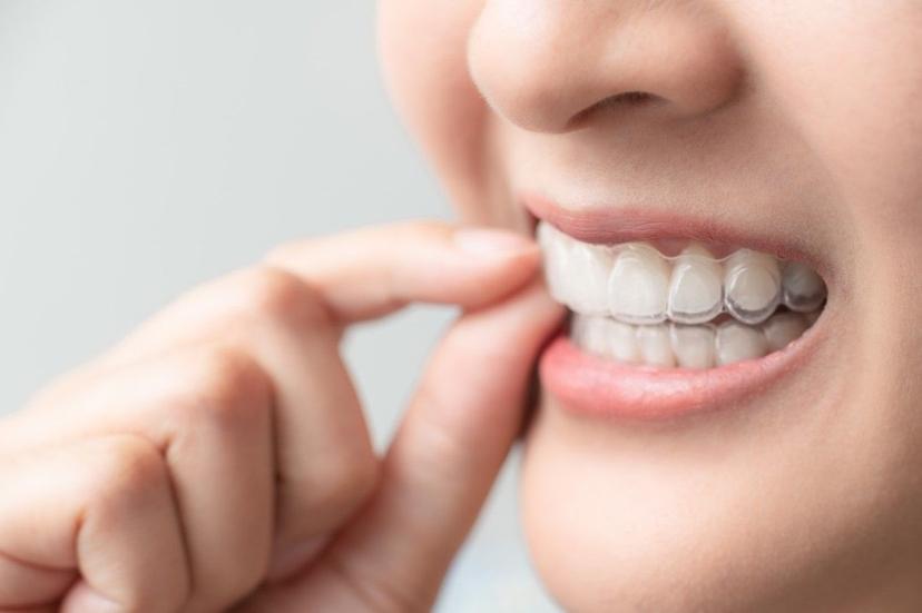 Loose tooth in Adults:  Symptoms, Causes, Prevention & Treatment