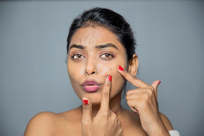 Tired of Acne Popping Up on Your Face? Read About These Types of Acne