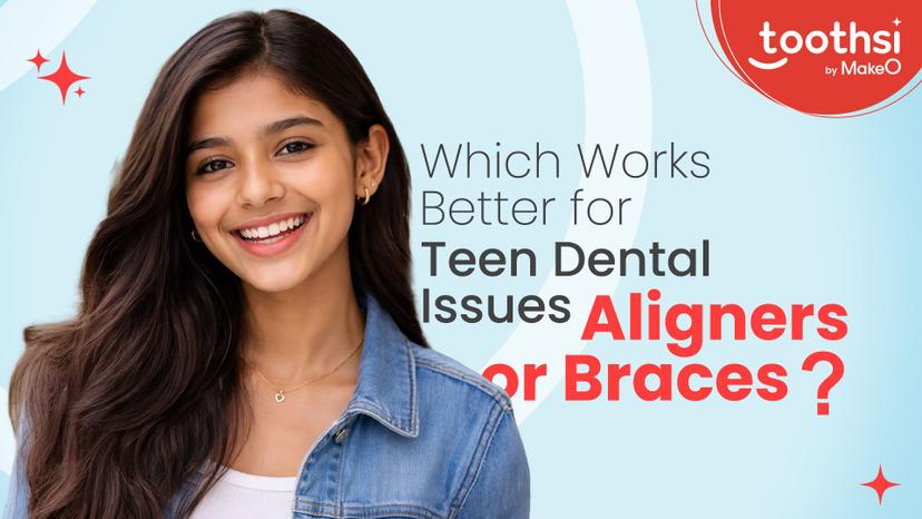 Aligners VS Braces: Which Option Is Better for Teenagers?