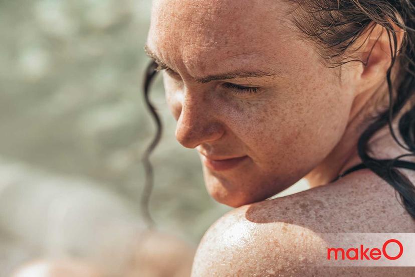 How Are Freckles and Sunspots Different?