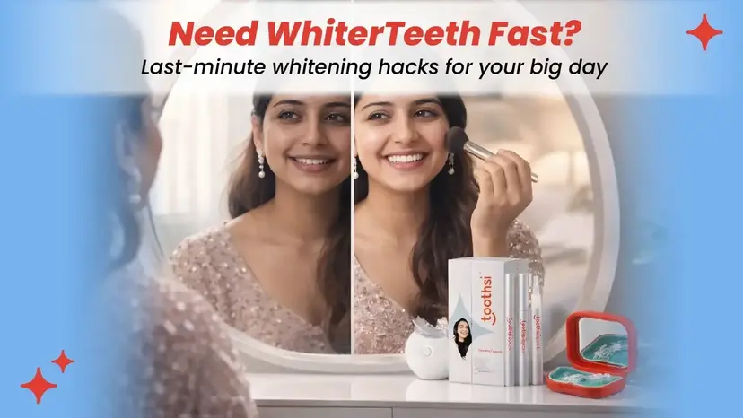 How to Whiten Teeth Fast for Special Occasions | Last-Minute Hacks