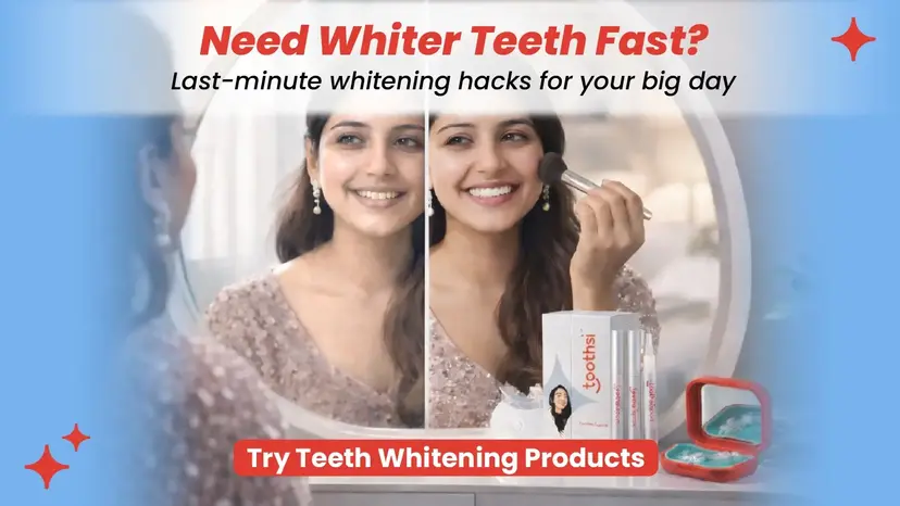 How to Whiten Teeth Fast for Special Occasions | Last-Minute Hacks