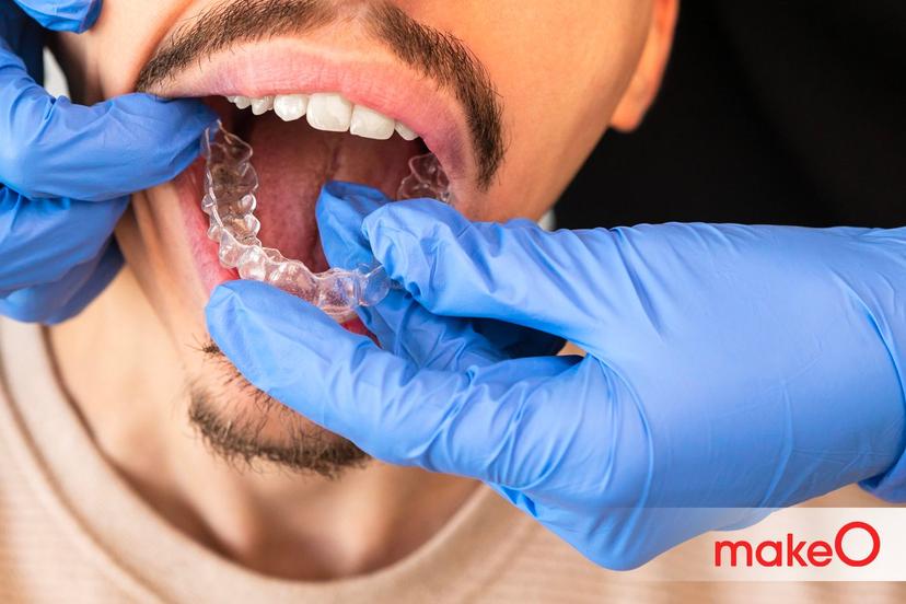 Can Misaligned Teeth Cause Speech Impediments?