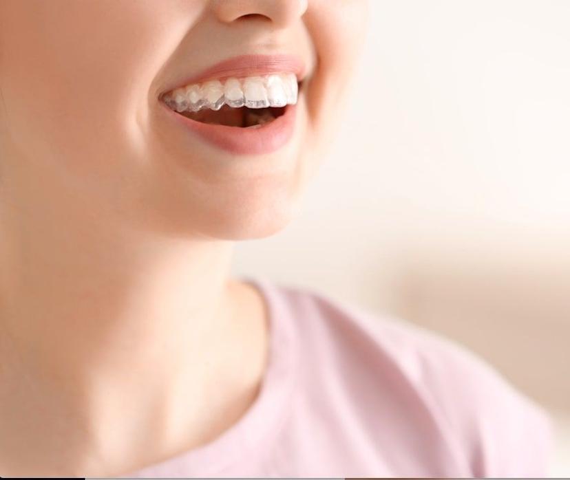Living with aligners: Dealing with 10 Common Dental Discomforts