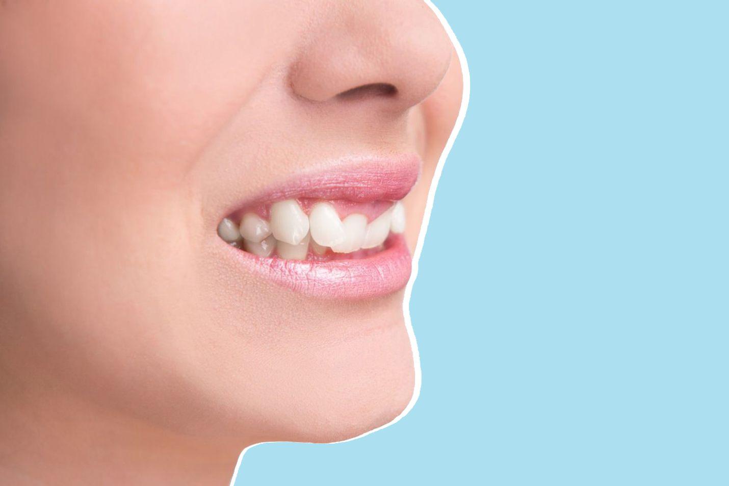 teeth shifting causes symptoms treatments