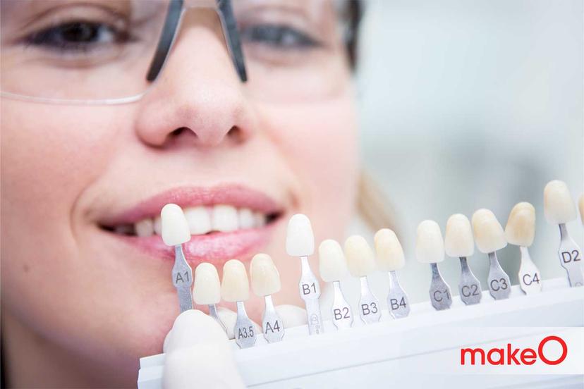 What Are Mamelon on Teeth? Do You Need to Remove Them?