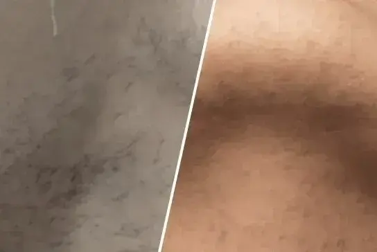 before-after