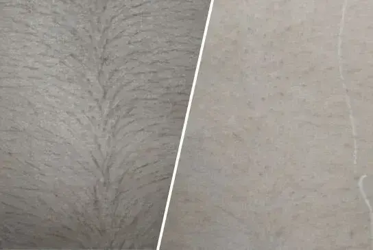 before-after