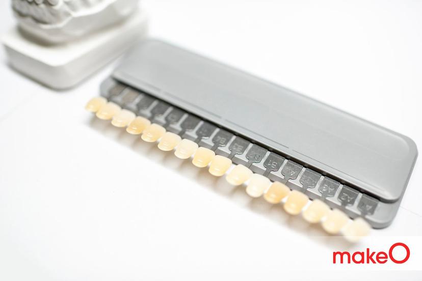 Dental Veneers: What You Should Know About Them