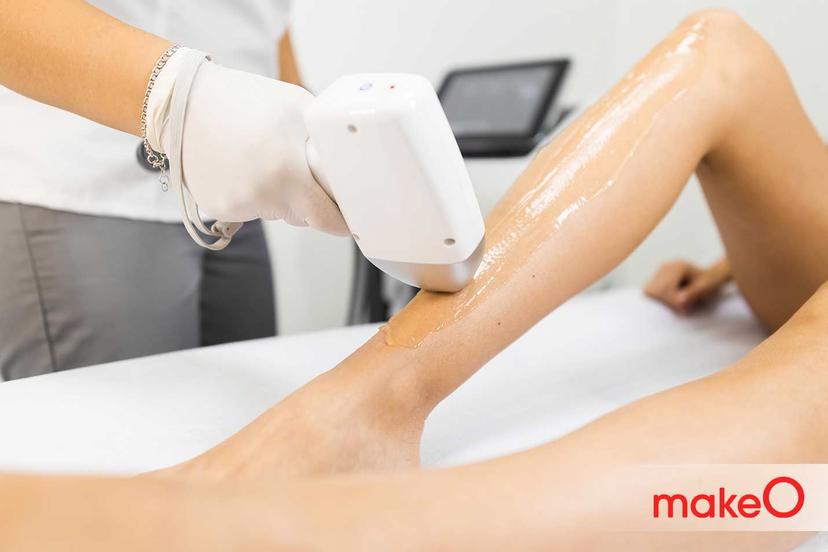Wedding Date Fixed? Here's When To Book A Laser Hair Removal Session