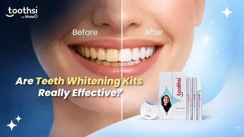Best Teeth Whitening Kits | At-Home Whitening Guide