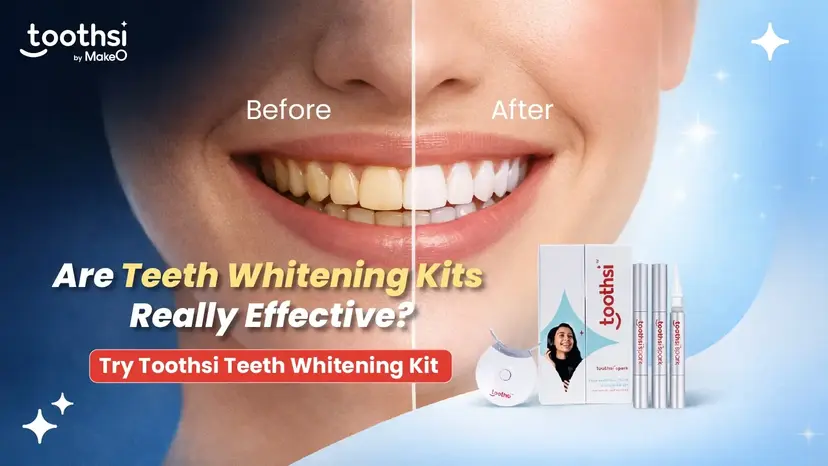 Best Teeth Whitening Kits | At-Home Whitening Guide