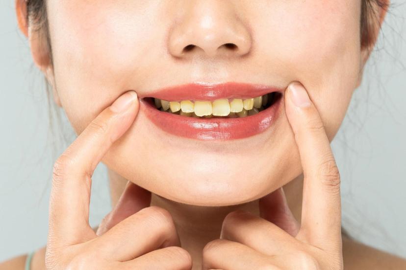 Teeth Scaling: Cost, Benefits & How it Works