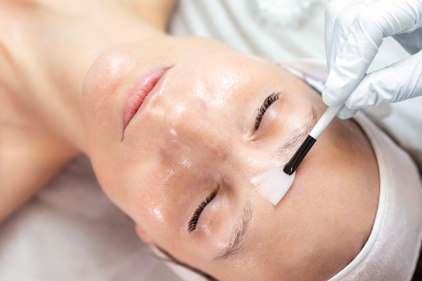how often should you get a chemical peel