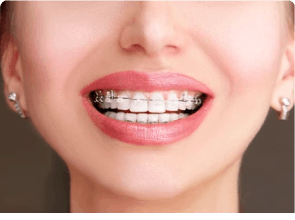 10 Ways to Make Your Child's Braces Pain Manageable