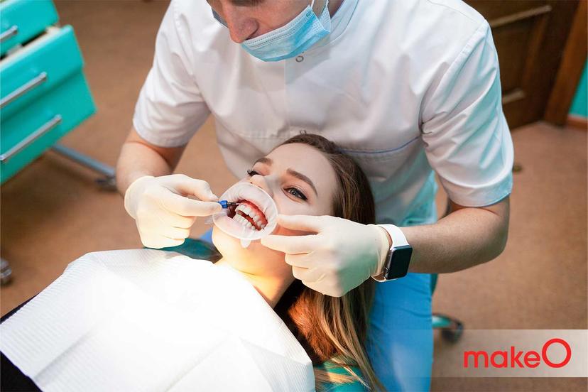 The Difference Between Cheek Retractors and Mouth Props
