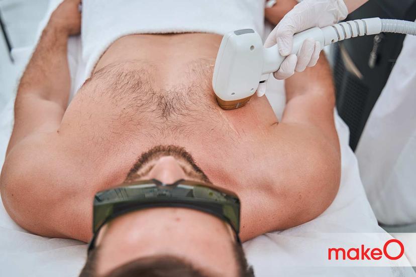 A Guide to Laser Chest & Abs Hair Removal For Men