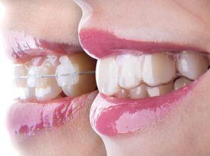 10 Tips to Help You Manage Braces Pain In The First Week
