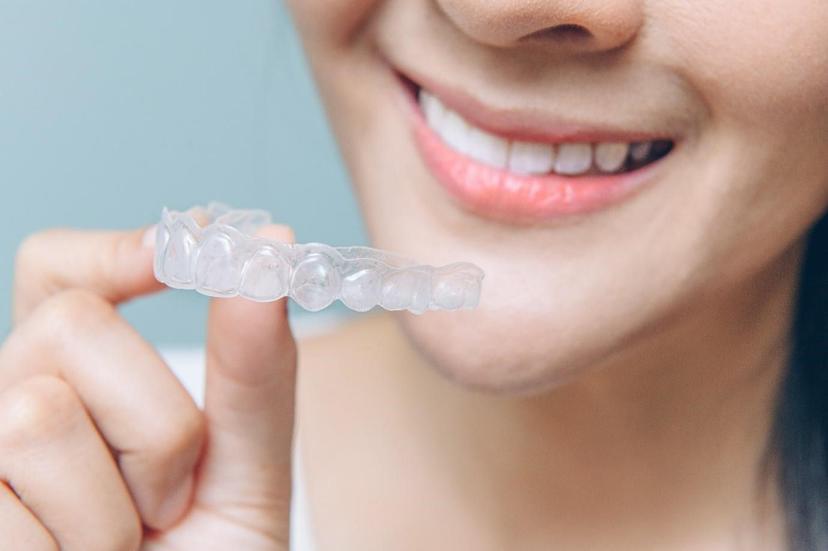 A Conclusive Guide on What Is a Retainer for Teeth