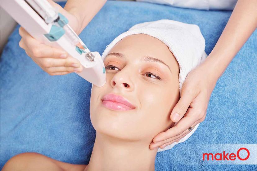 Mesotherapy for Hair: Is This Treatment Effective for Hair Loss?