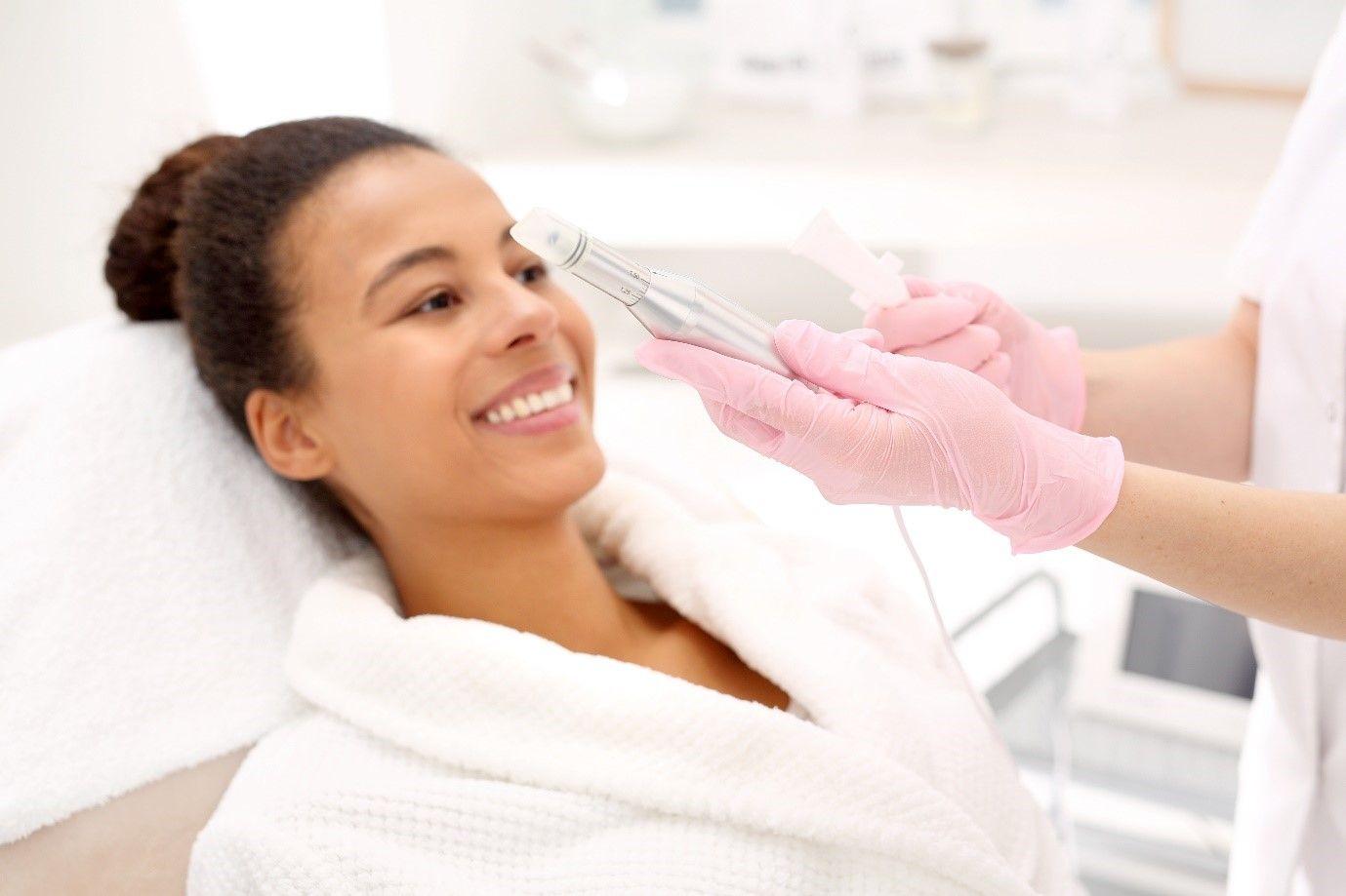 microneedling for acne scars