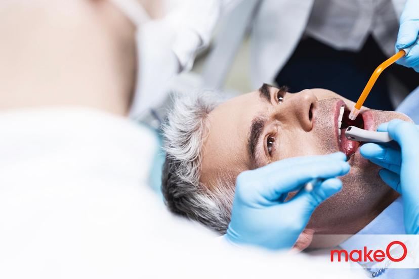 Know All About The Root Canal Procedure