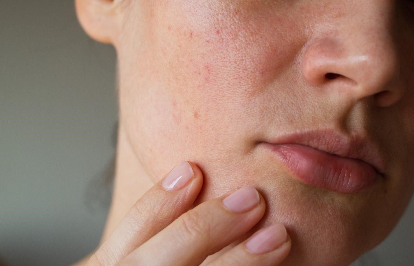 sensitive skin causes and symptoms