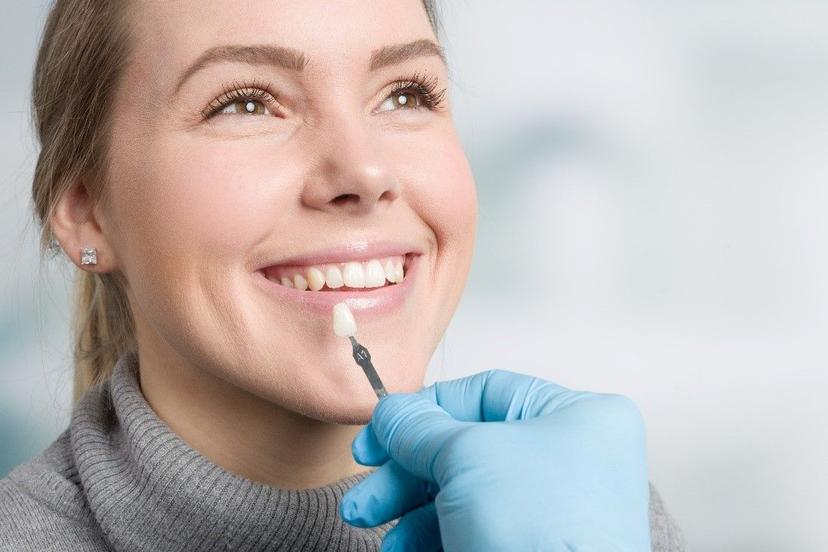 Transform Your Smile with Teeth Veneers: Costs, Benefits and Procedure